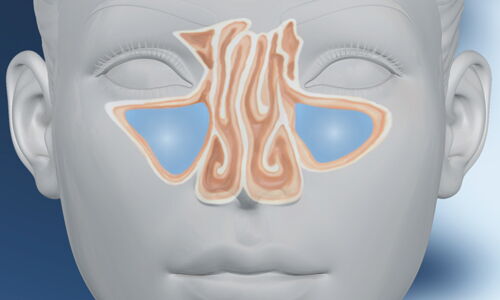 Anatomie für Nasen-OP