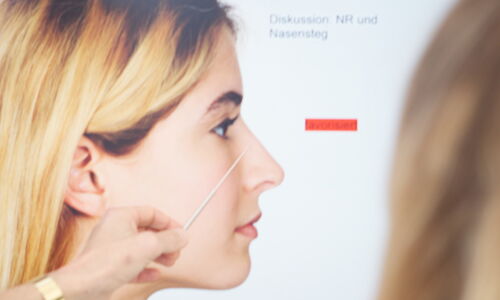 Reoperation of the nose