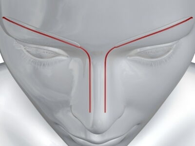 Nasenkonfigurator für Nasen-OP